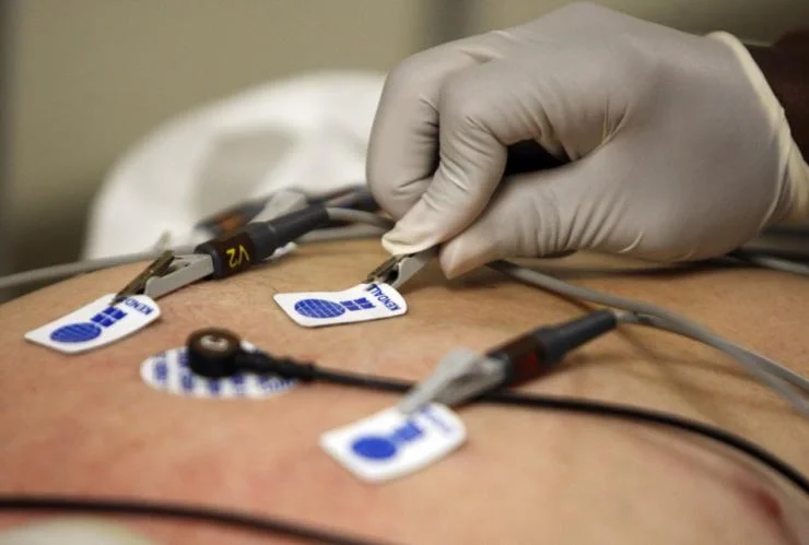 ECG electrodes being placed on a patient at Nabade Clinic